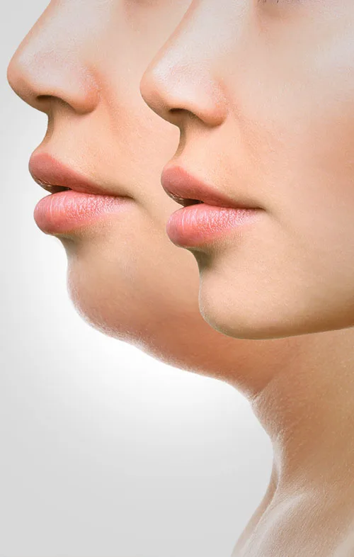 santiago-gonzalez-marcacion-facial-4b